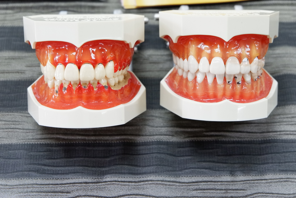 replica teeth from top view